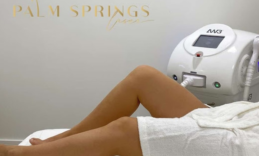 Image 1: Reveal Smoother Skin at Palm Springs Laser Through Laser Hair Removal 