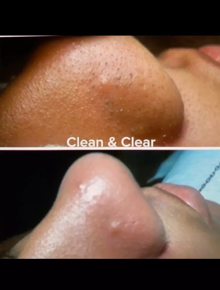 One or Two 75 Min Deep Cleansing Facial + Microdermabrasion and More