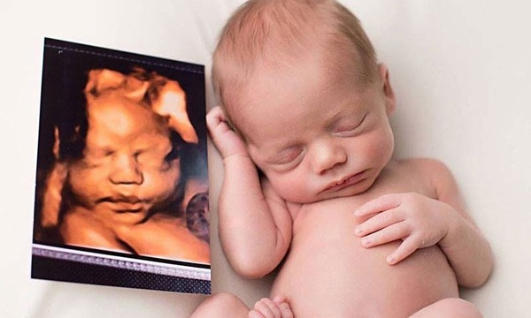 EcoBB 5D Hasta 25% Alzira Groupon