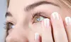 One or Three PRF Natural Under-Eye Dark Circle and Puffiness Treatment at Lov Med Spa - Brooklyn - Upto 50% Off