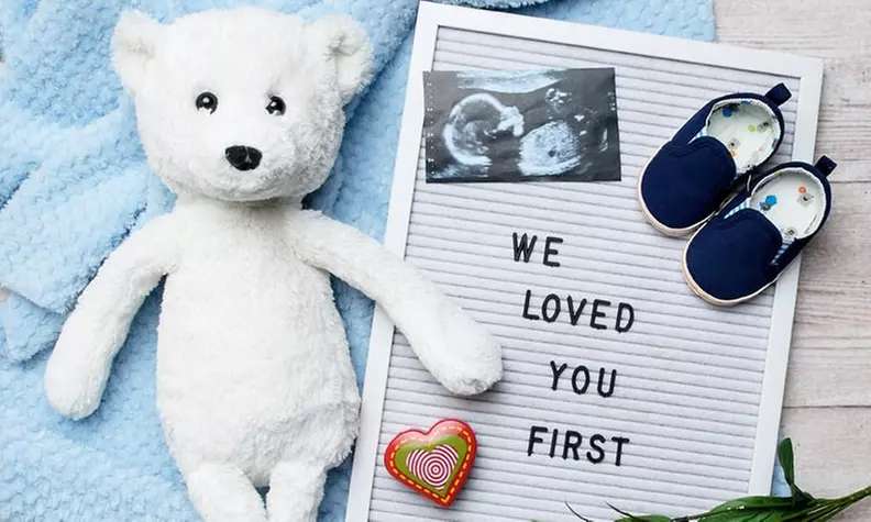 2D or 3D/4D Baby Ultrasound Packages with Photos & More at Stork Vision (Up to 40% Off). Four Options Available. - Primary Image