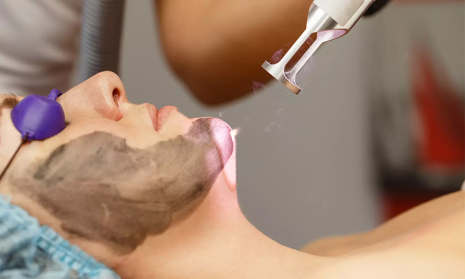 One or Two Carbon Laser Peels with LED Treatment at Labelle MedSpa (Up to 50% Off) - Primary Image