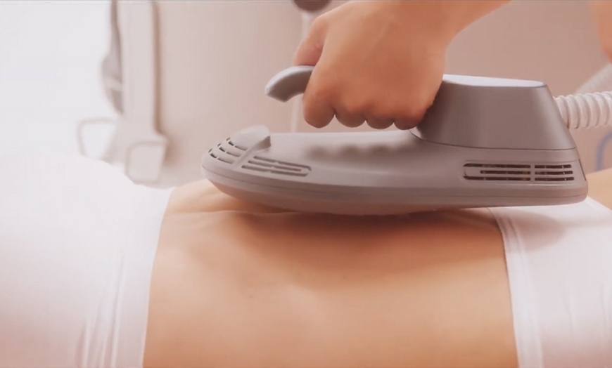 Image 1: Silueta definida con Emsculpt en centro experto, varias zonas a elegir