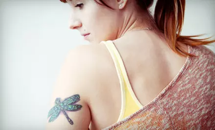 1 Laser Tattoo-Removal Session for Area of Up to 3, 5, or 8 Sq. Inches at Inflicting Ink Tattoo Removal (Up to 75% Off) - Primary Image