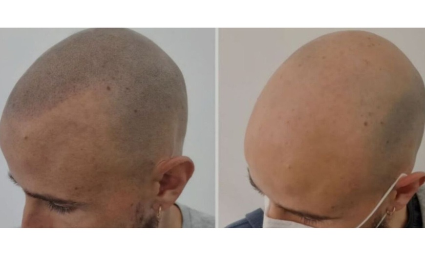 Image 11: Micropigmentación de labios acuarela, eyeliner, cejas o capilar SMP