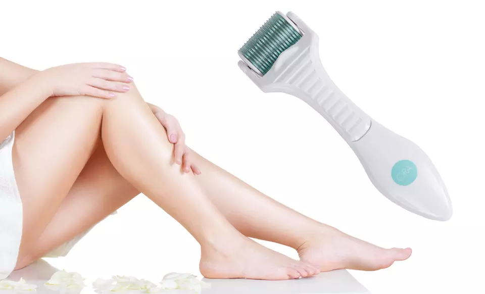ORA Microneedle Roller System with 1,080 Needles - Primary Image