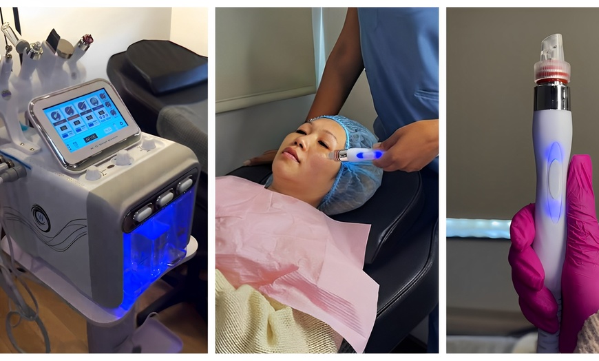 Image 1: Revitalize with One or Three Hydradermabrasion with Optional LED