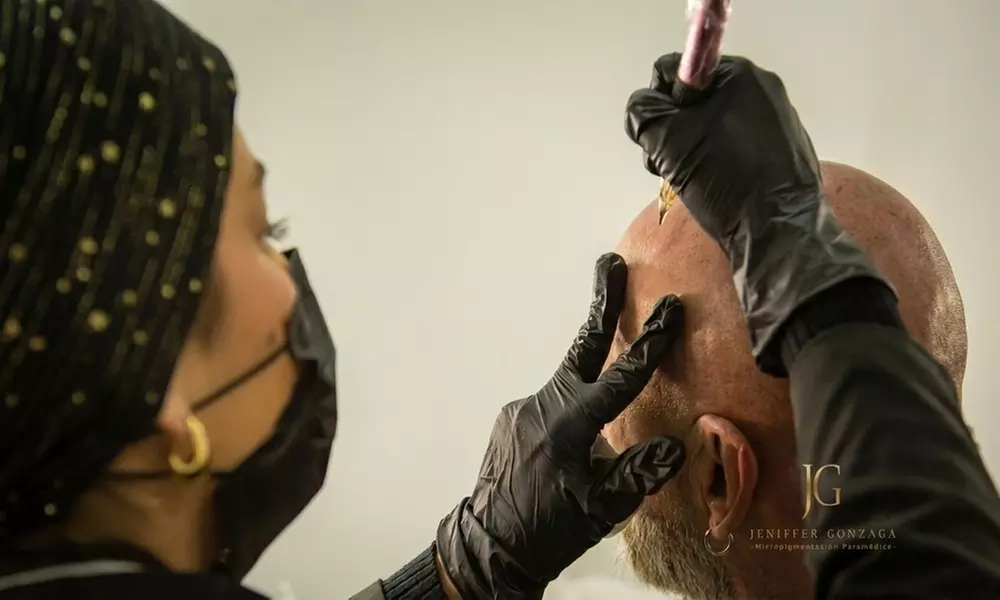 2 sesiones de micropigmentación capilar con técnica FUT o FUE