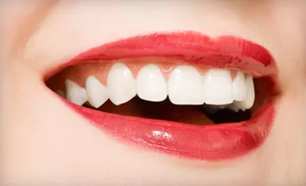 Teeth Whitening with Optional Remineralization or Remineralization and Maintenance Kit at Two Spa (Up to 56% Off) - Primary Image