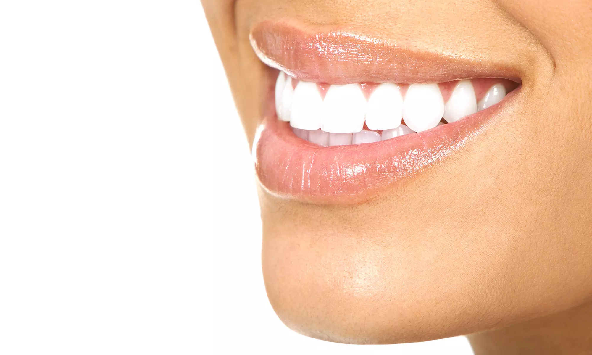 Dental Exam, Cleaning, and X-rays, or One or Two Porcelain Veneers at Austin Primary Dental (Up to 88% Off) - Primary Image