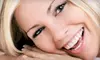 One or Two Teeth-Whitening Treatments at Pearly Whites (Up to 56% Off)