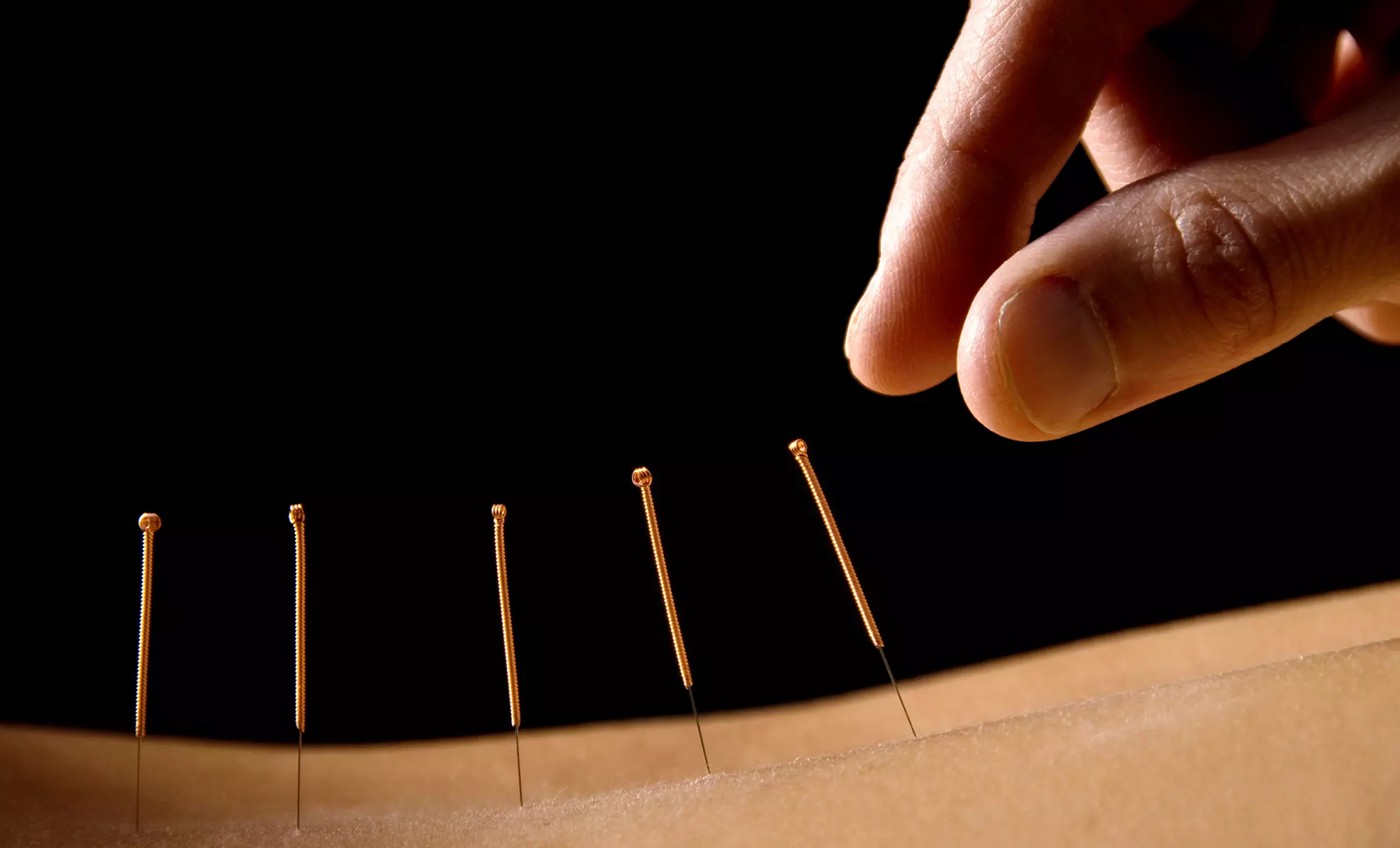 $159 for Three Acupuncture Treatments at Princeton Acupuncture & Oriental Medicine ($320 Value) - Primary Image