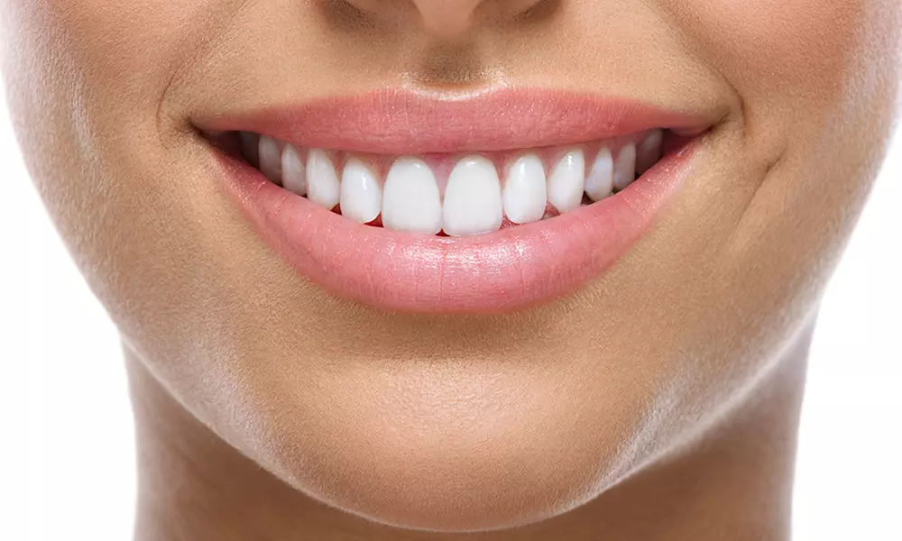 Braces For Upper and Lower Arches for £1,450 at Bridge Street Dental Practice (59% Off) - Primary Image