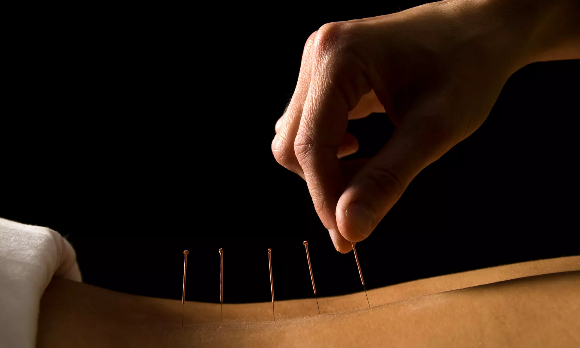 Consultation and One or Three Acupuncture Treatments at Source Centre for Health and Wellness (Up to 78% Off) - Primary Image