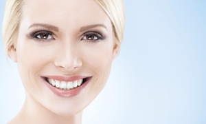 Teeth Whitening - Deals &amp; Coupons | Groupon