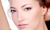 One or Two Custom Medical-Grade Cleansing Facials at SpaDerma (Up to 64% Off)