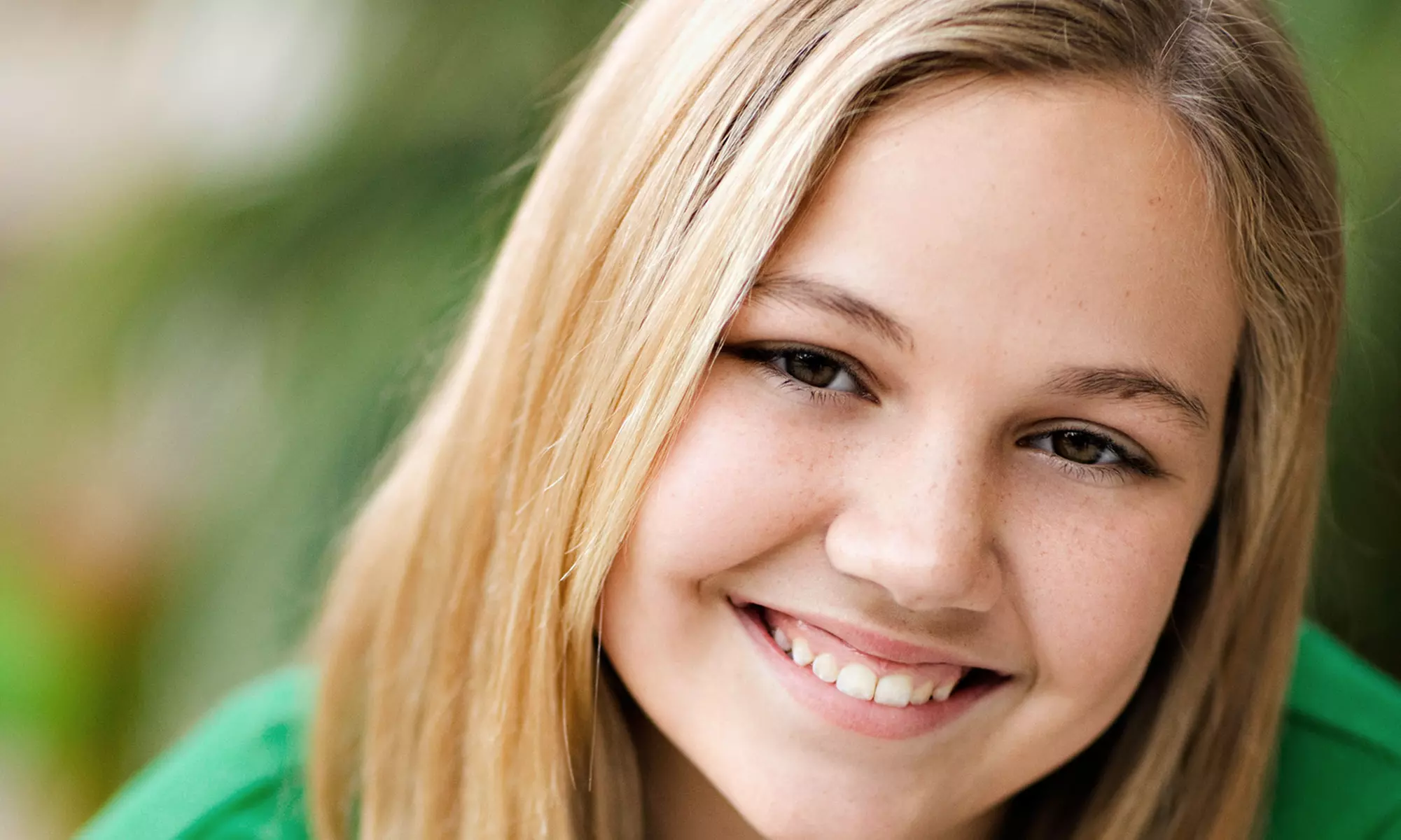 Dental Deep Cleaning at Summer Smile Dental (Up to  Off) - Primary Image