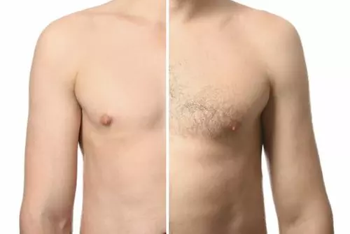 Laser Hair Removal Sessions for Various Areas
