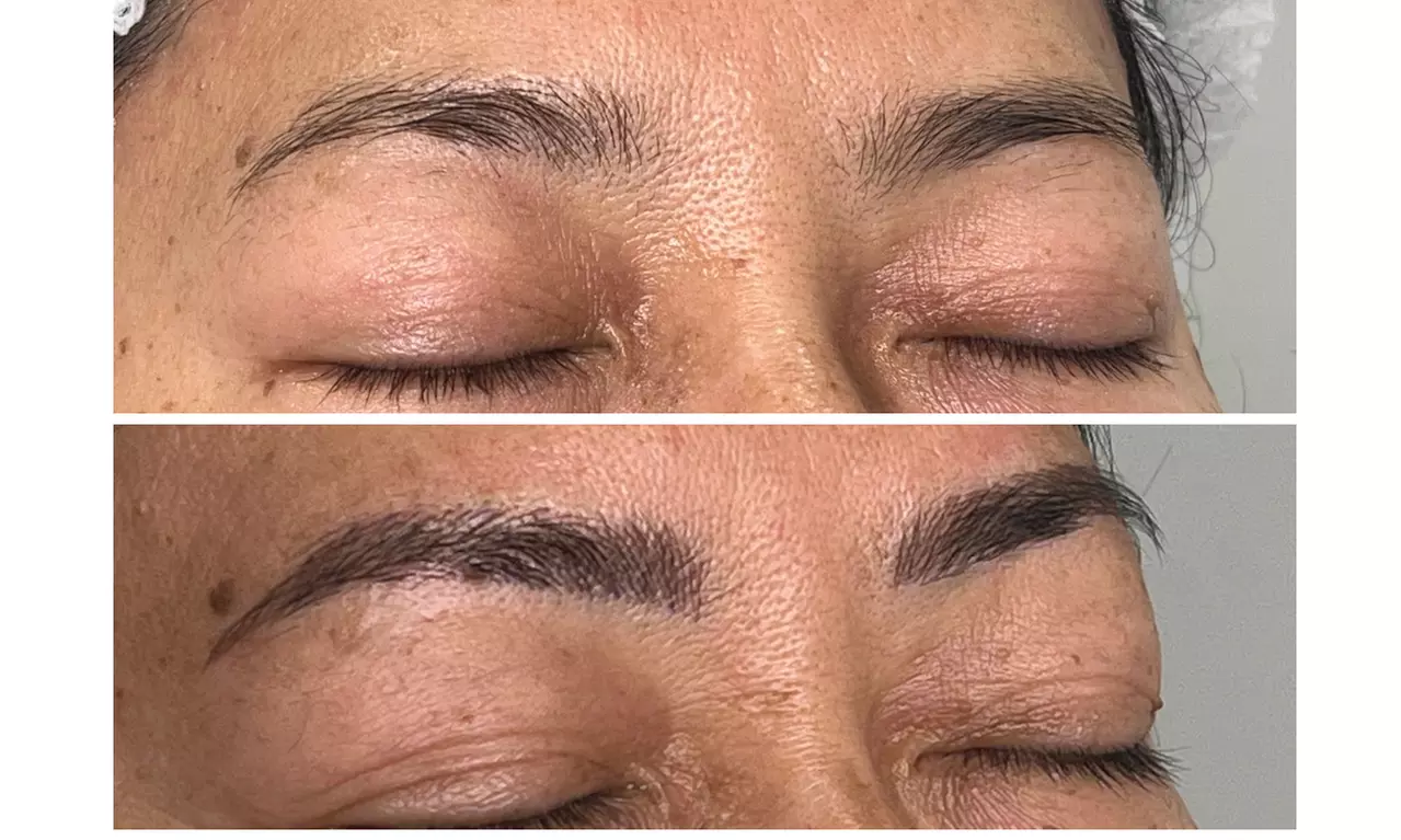 Microblading Session at Elizabeth Beauty and Laser – Professional Brow Enhancement