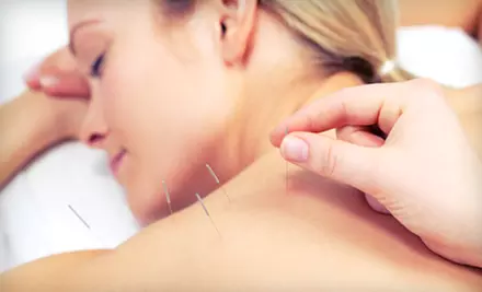 One or Three Acupuncture or Chiropractic Treatments at Oaktree Chiropractic & Acupuncture (Up to 91% Off) - Primary Image
