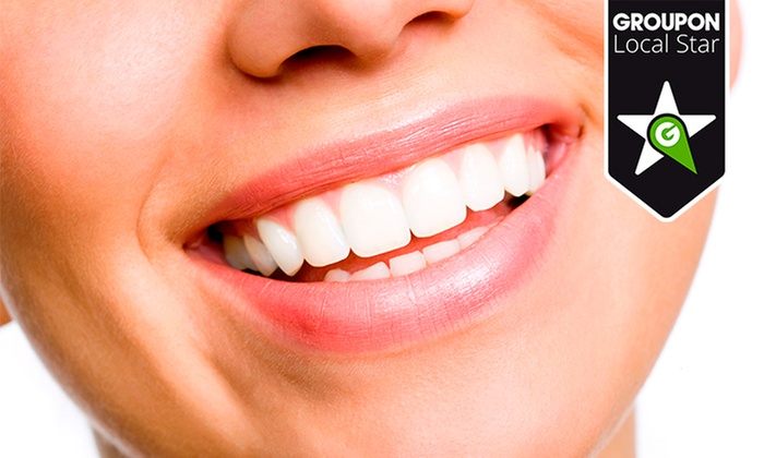 Ideo: férula descarga y limpieza