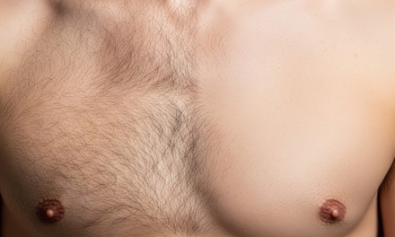 Man Waxing - Back - Classic Beauty London