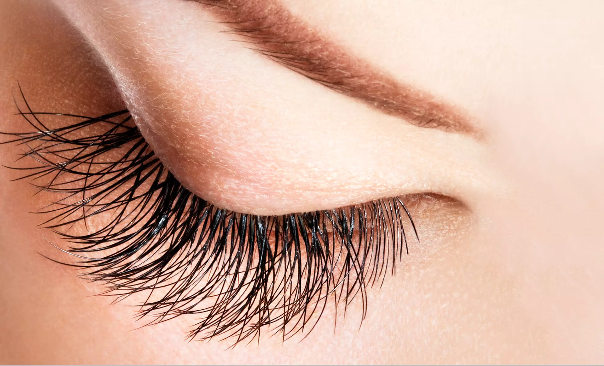 Eyelid Surgery on the Upper or Lower Lids or Both at Strax Rejuvenation (Up to 57% Off) - Primary Image