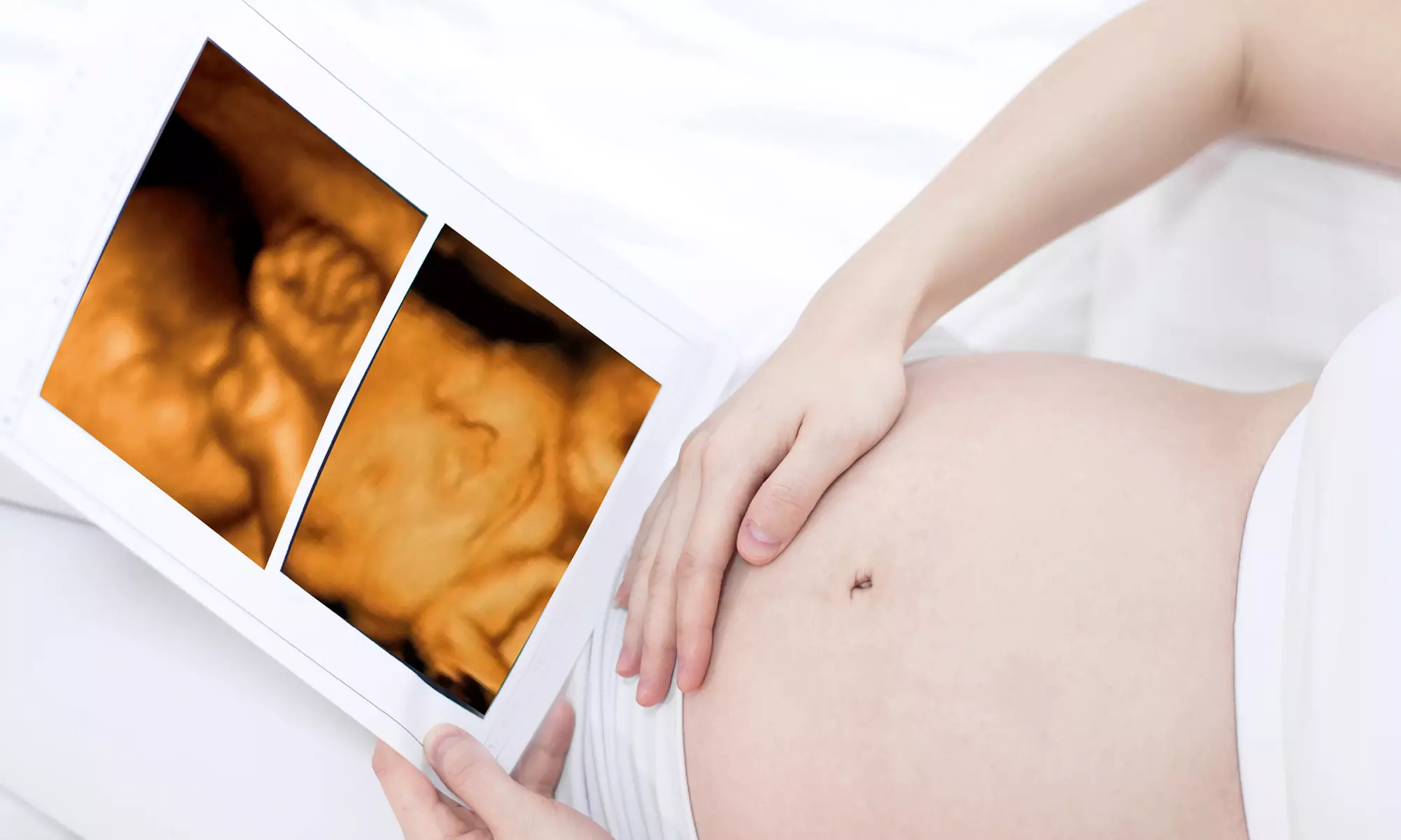 1 ecografía de tu bebé en 4D o 5D con opción a fotos, canastilla y más