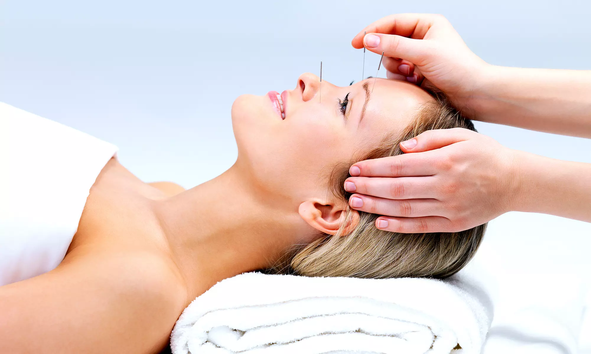 Acupuncture or Skin Rejuvenation Treatments at Hands & Needles Acupuncture (Up to 54% Off) - Primary Image