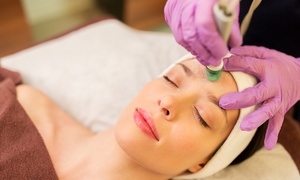 Up to 83% Off on Microdermabrasion at GD beauty room