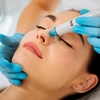 Image 1: 1 o 2 sesiones de tratamiento facial con hidrodermoabrasión y más