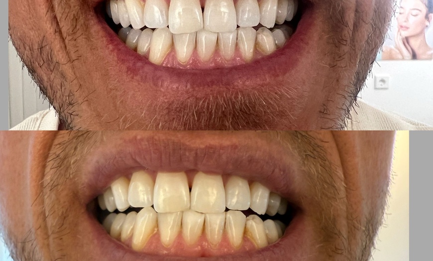 Image 3: Bis zu 46% Rabatt auf den  bei Esthétique de paris