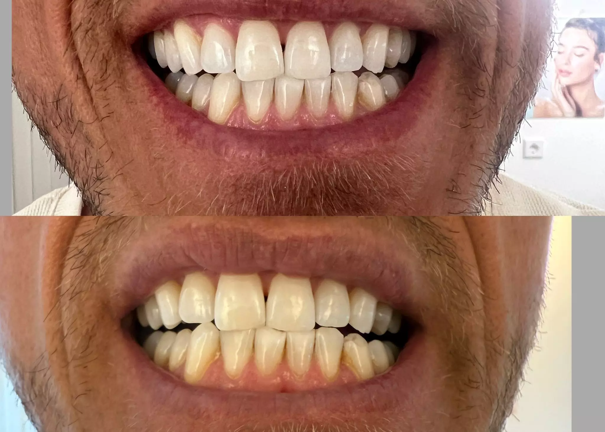 Bis zu 46% Rabatt auf den  bei Esthétique de paris