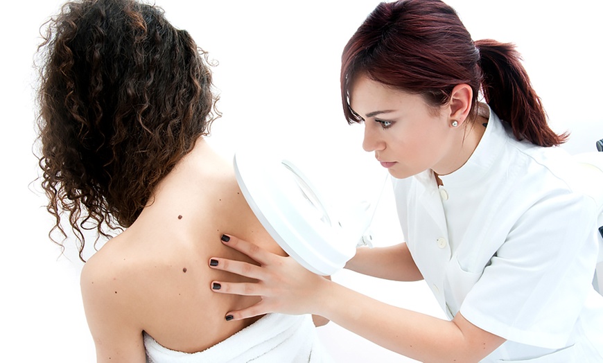 Image 1: Three Skin Tag Removal Sessions