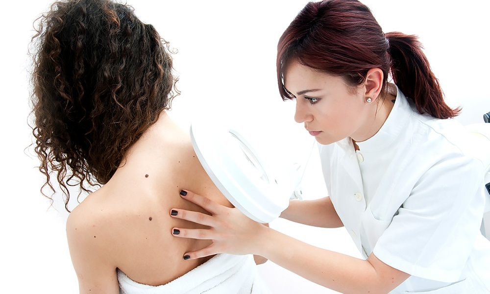 Three Skin Tag Removal Sessions