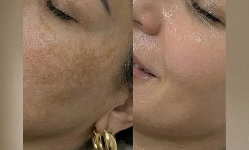 Image 18: Unifiez votre teint avec un soin anti-taches ciblé 5G Removal