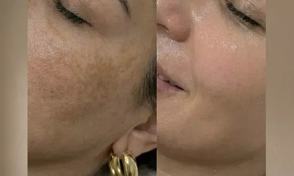 Unifiez votre teint avec un soin anti-taches ciblé 5G Removal