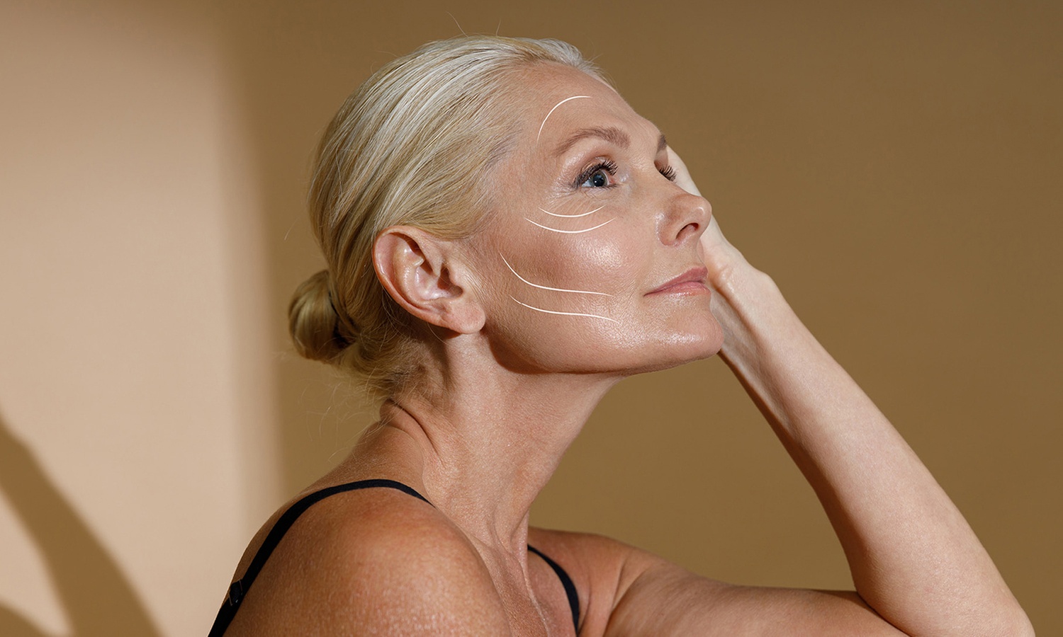 Non-Surgical Protein Face Lift at Miami Kiss