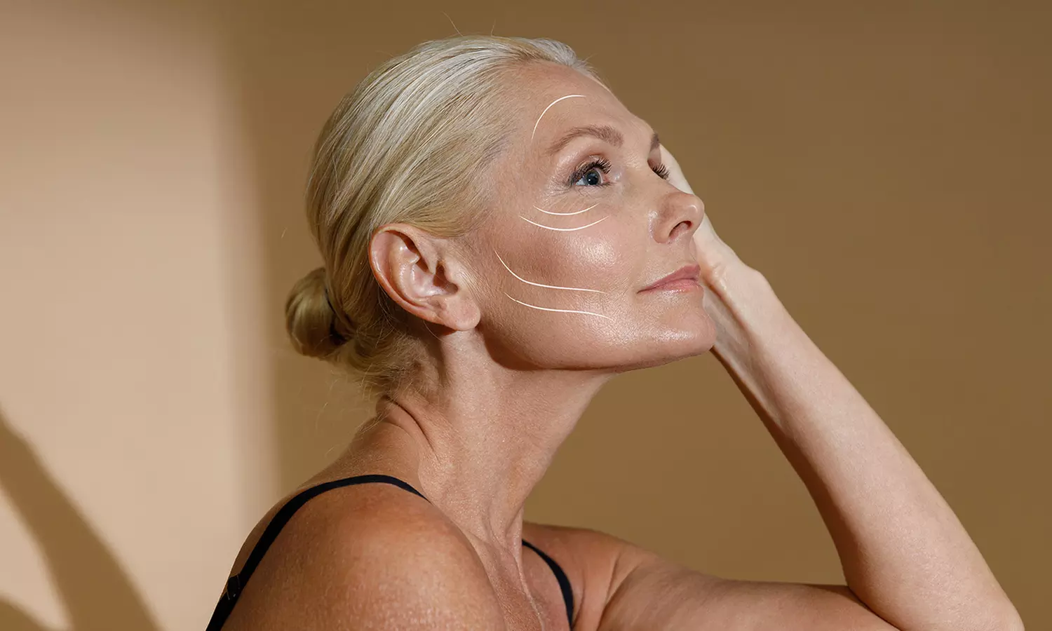 Non-Surgical Protein Face Lift at Miami Kiss