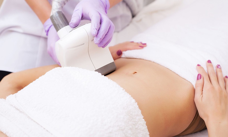 Image 4: Tratamiento reductor anticelulítico, radiofrecuencia y cavitación