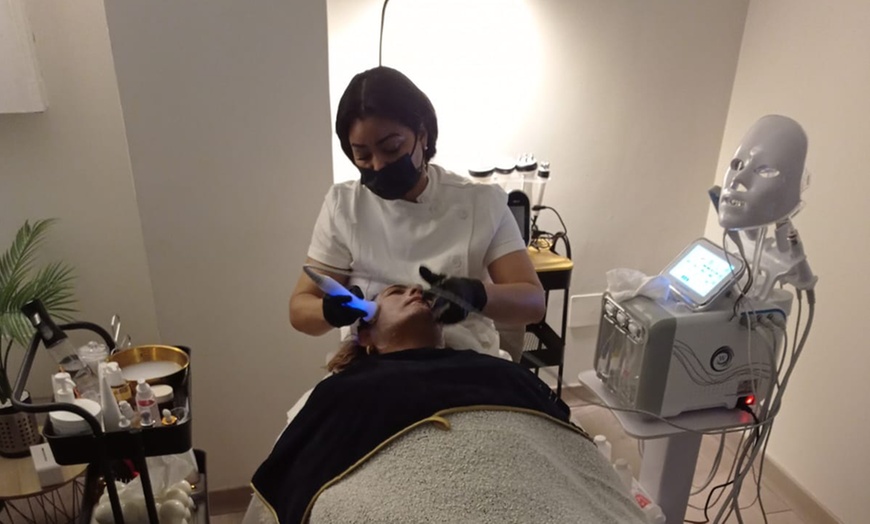 Image 3: Hydra facial, radiofrecuencia, fototerapia y electroestimulación