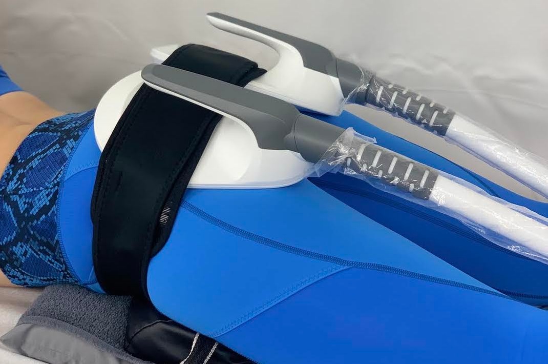 Electromagnetic Stimulation Session for Fat Reduction & Muscle Toning