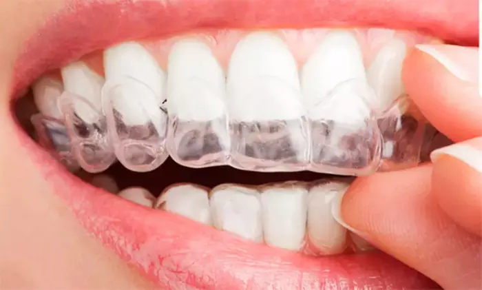 Limpieza dental con revisión, ortopantomografía, pulido y fluorización