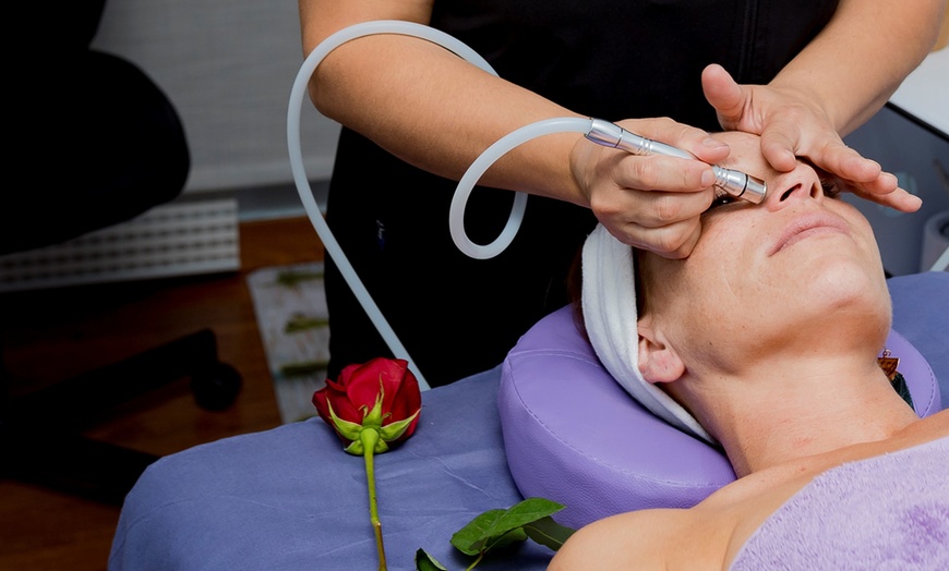 Image 1: Microdermoabrasión con opción a masaje facial en Monabella