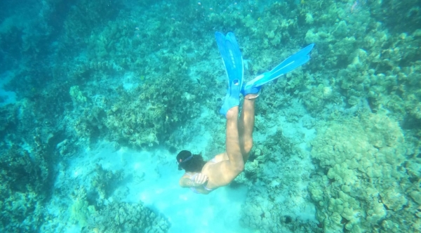 What to expect media