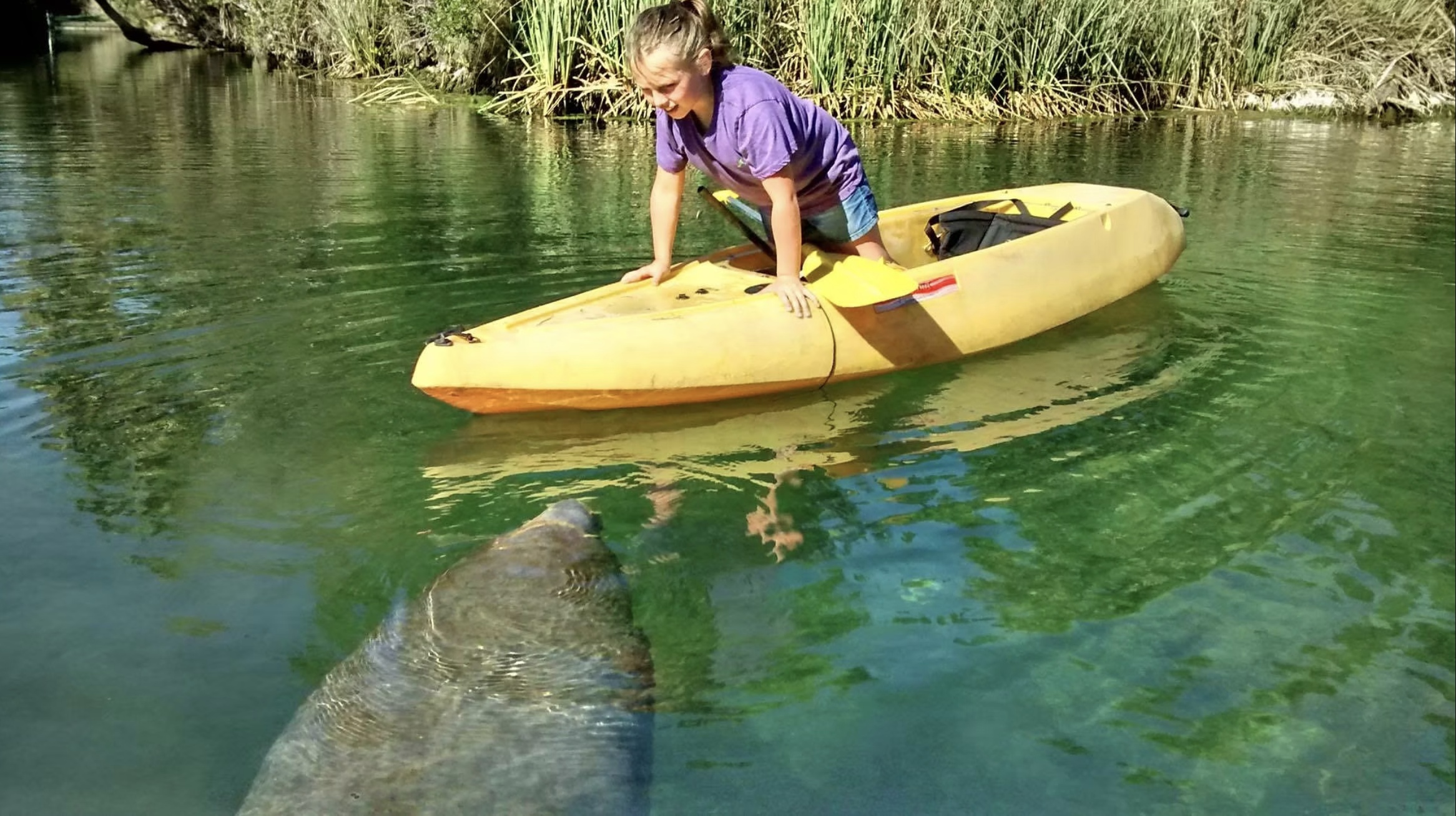 What to expect media