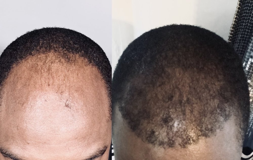 Glow Plastic Surgery & Aesthetics'n