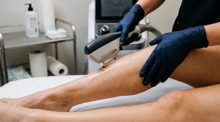Three Laser Hair Removal Sessions on One Small Area - Sovereign Skin Co