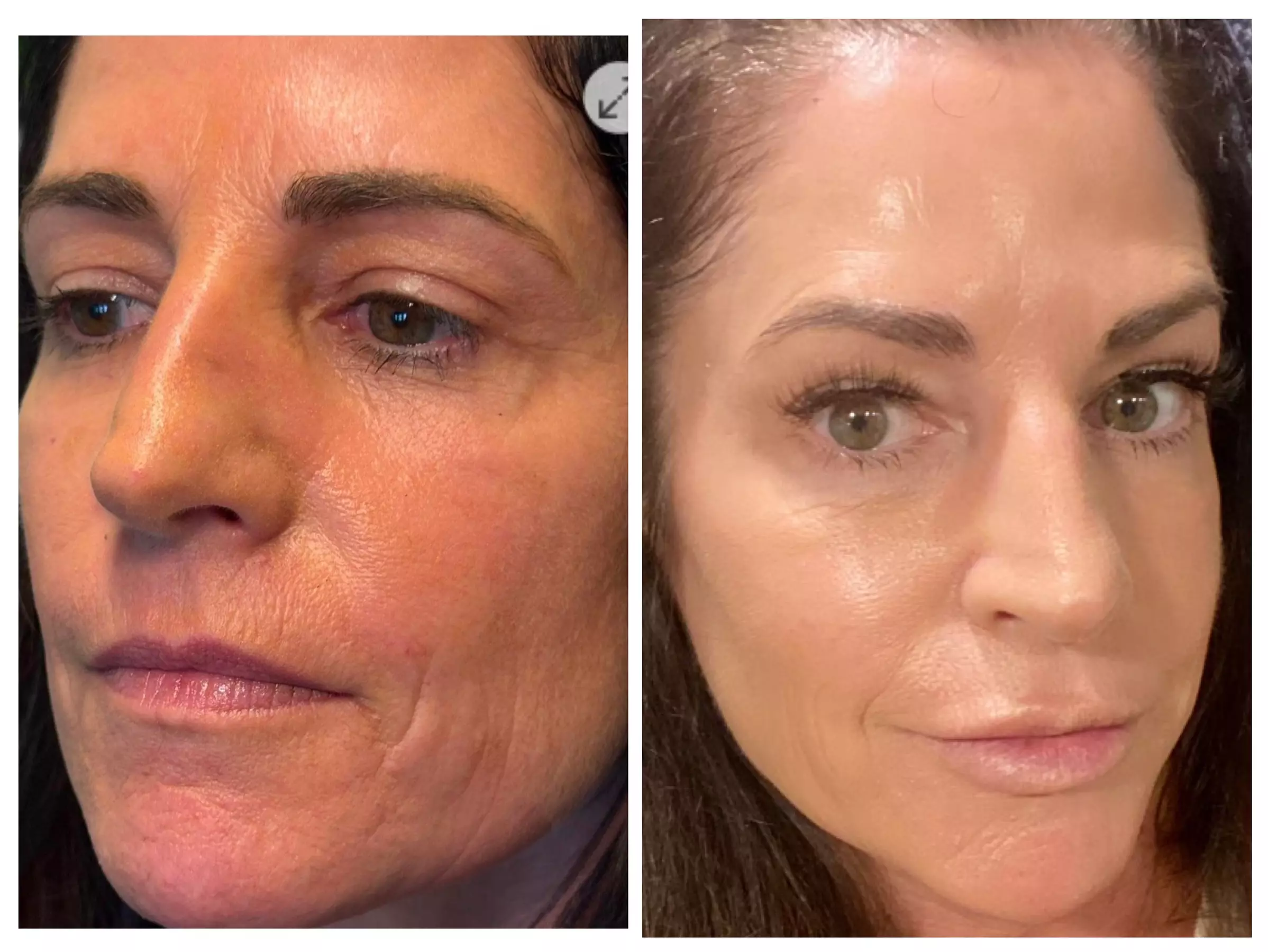 6 Laser Hair Removal Sessions: Small, Medium, Large/ Extra Large Area