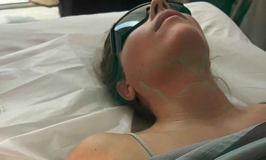Image 5: Up to 55% Off on Chin Sculpt & Chin Sculpt Max